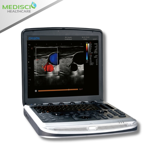 CHISON · SonoBook